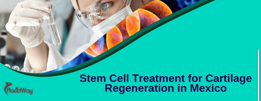Stem Cell Treatment for Cartilage Regeneration in Mexico